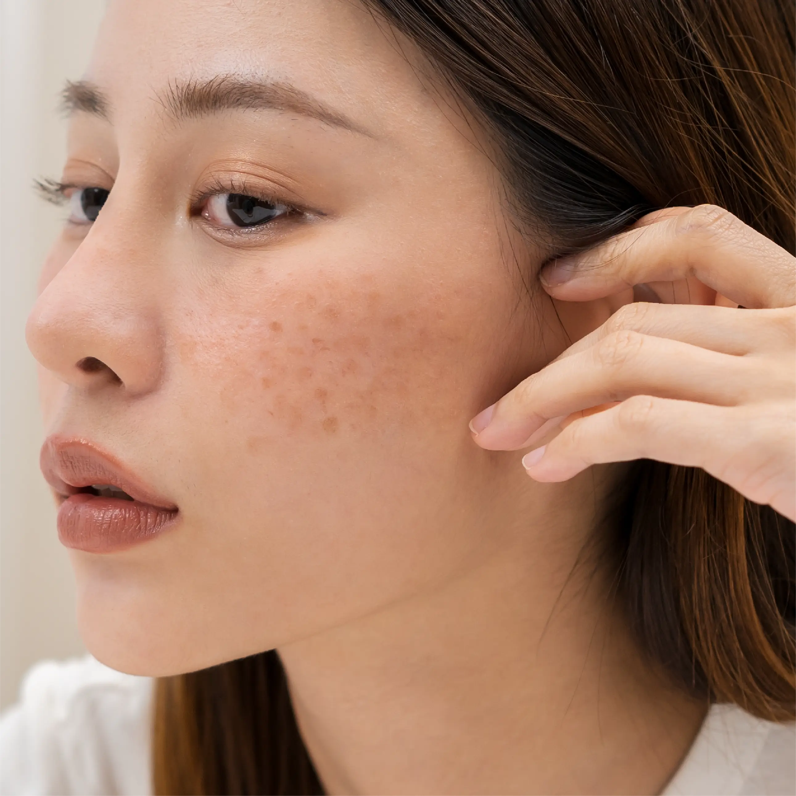 Bollin-Clinic-dermatology