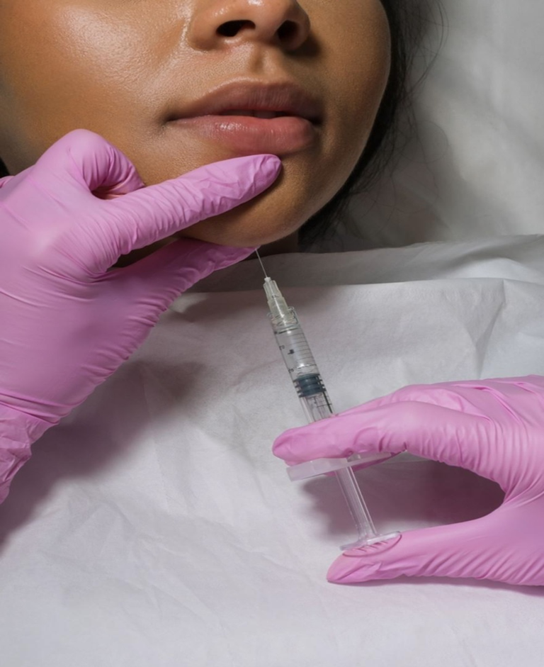 Best Juvéderm Dermal Fillers in Altrincham, UK