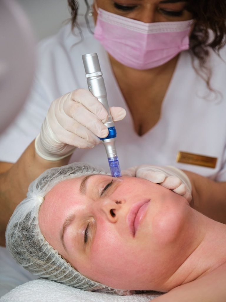 Advanced Microneedling Treatment in Altrincham, UK