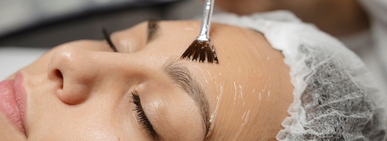 Best Chemical Peels in Altrincham, UK